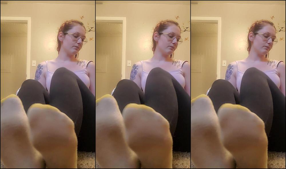 Kelsi Baby Itchy Athletes Foot