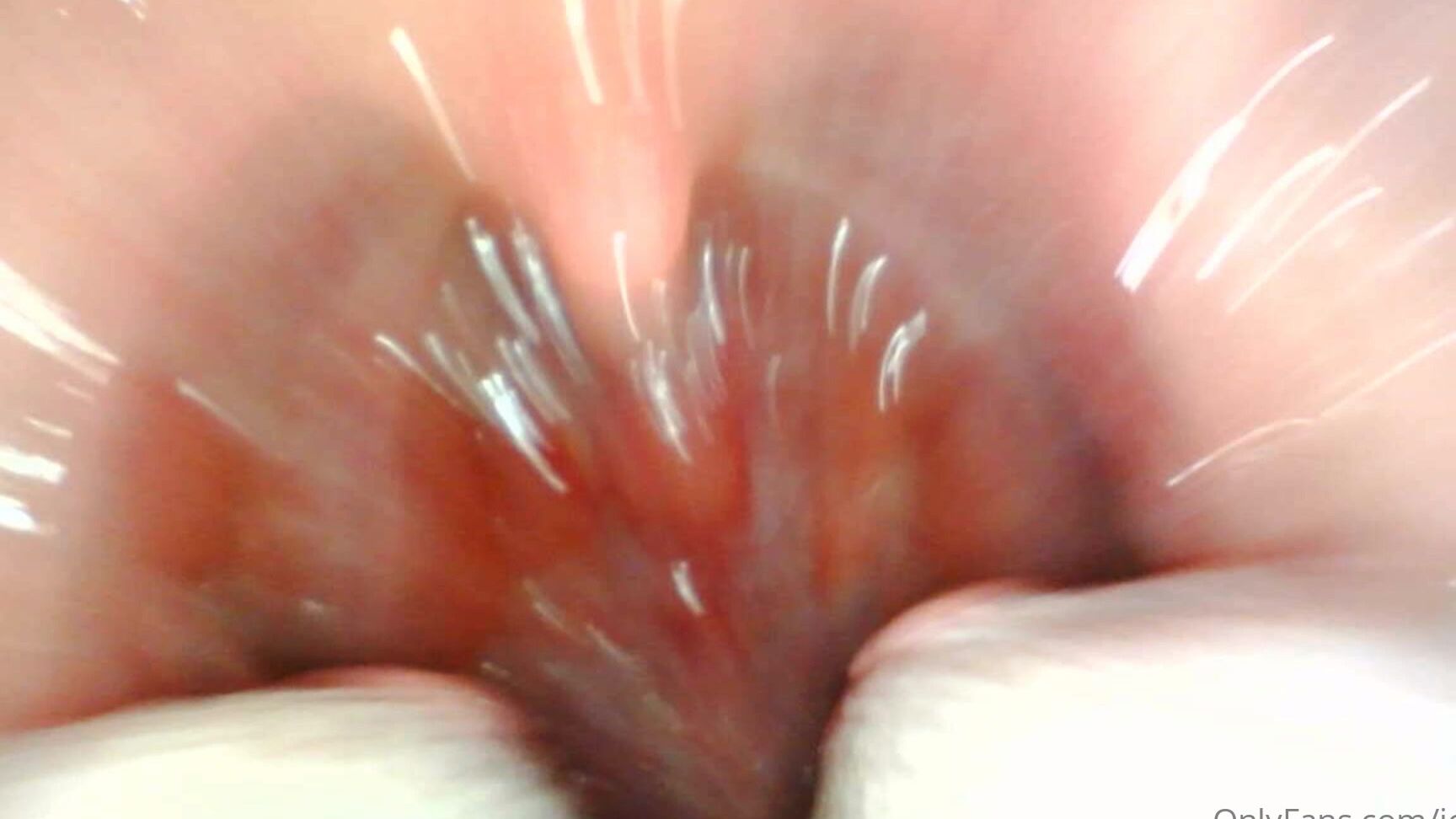 Gtsgoldenlace Endoscope Mouth Fuck