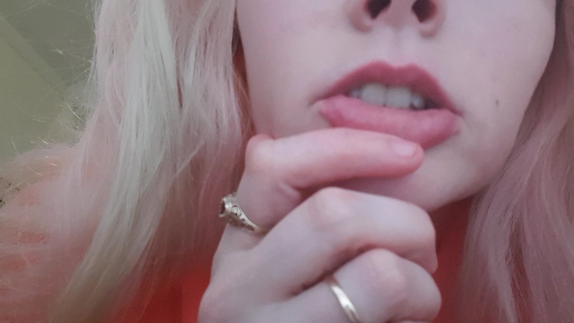 Sydneyharwin Waiting For Mom At My Window