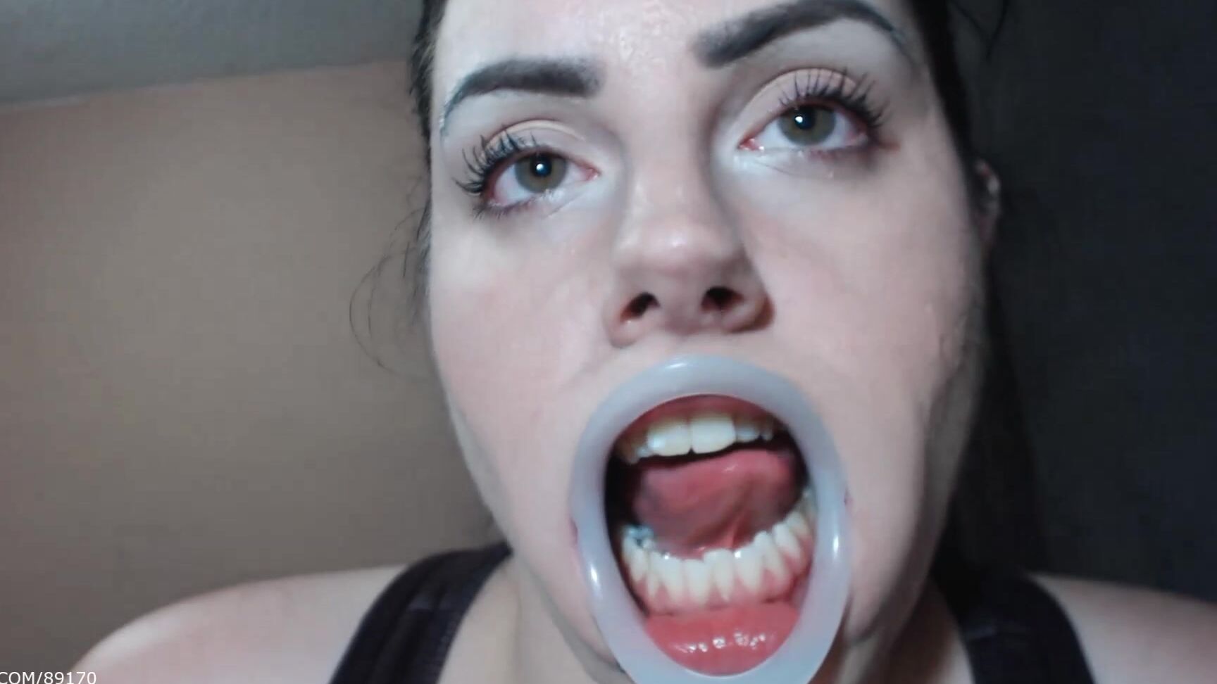 Booty U Dental Mouth Opener