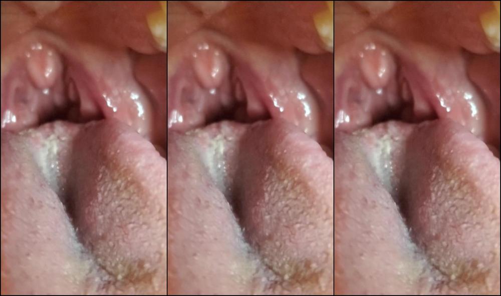 Tootsiepoptoes Watch Me Deep Throat And Ch Ke Down A Fruit Snack