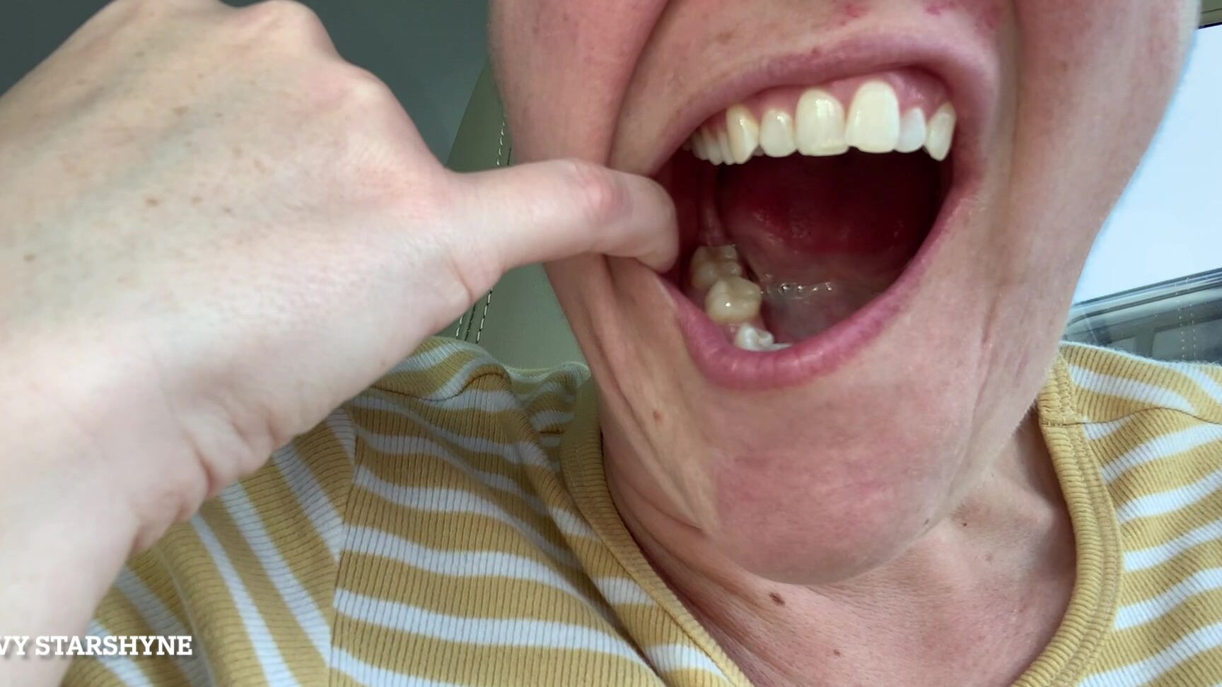 Ivystarshyne Dental Frustrations New Mouth Tour