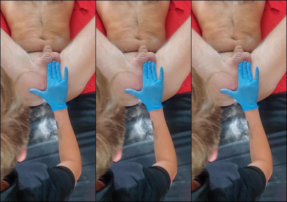 Skysugaring 3572586116 11 20 2024 Butthole Sugaring