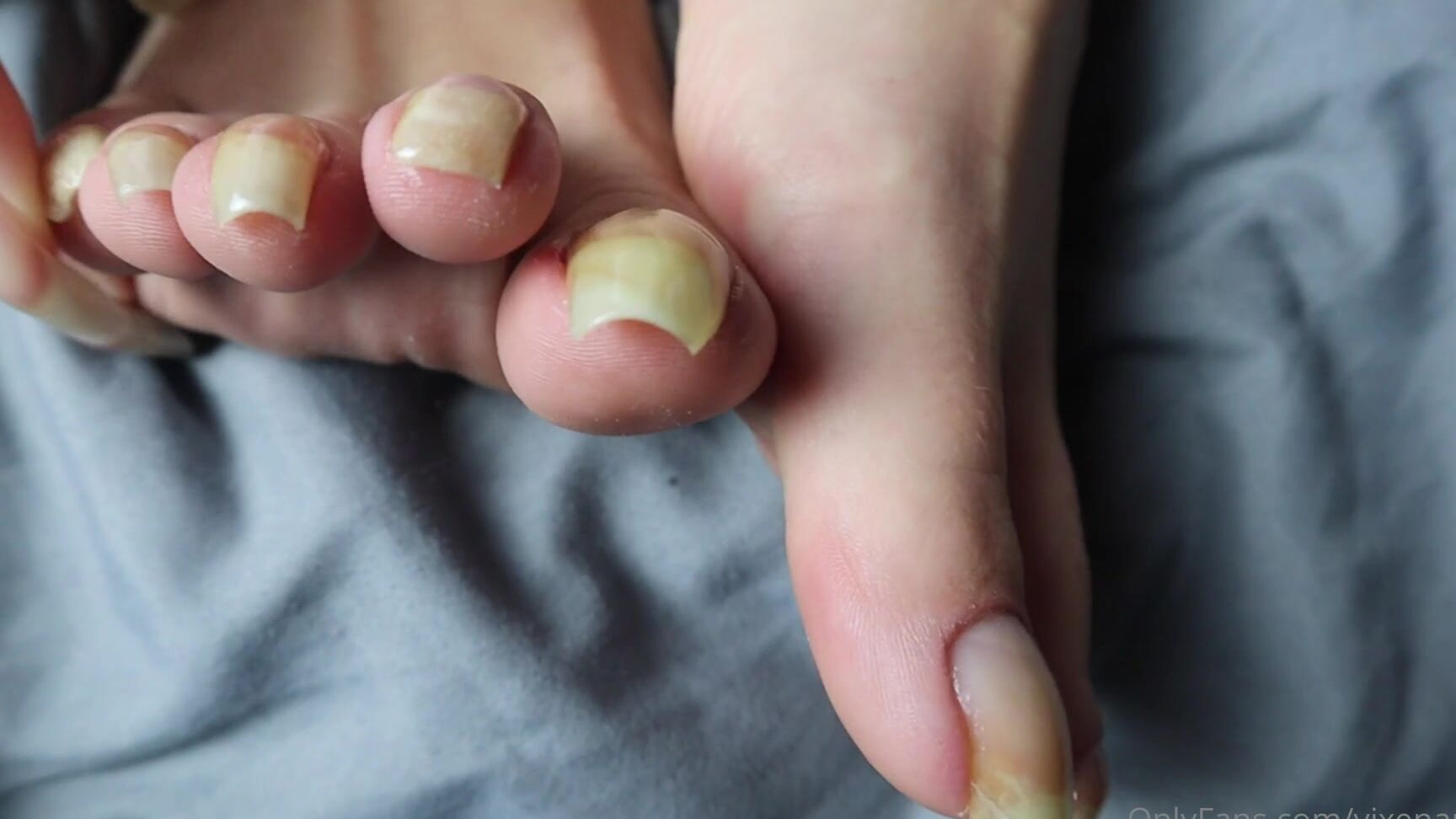 Vixenarches Measuring My Bare Toenails At Their Longest Ever Record Length K Video