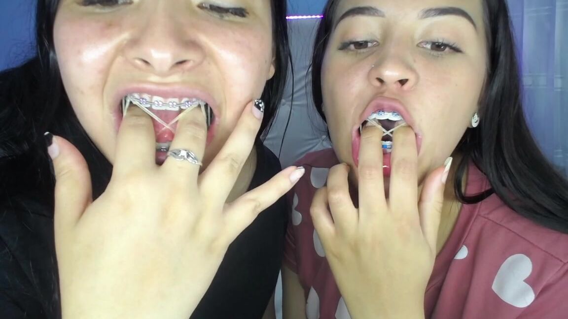 Braces,Orthopedic Brace Fetish,Spit Fetish,Teeth miaisabella3 our mouths braces and tongue tour ManyVids