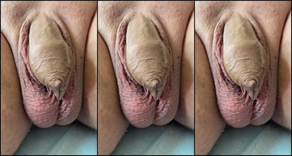 Parade Af Mandlige Og Kvindelige K Nsorganer Af Sugarnadya