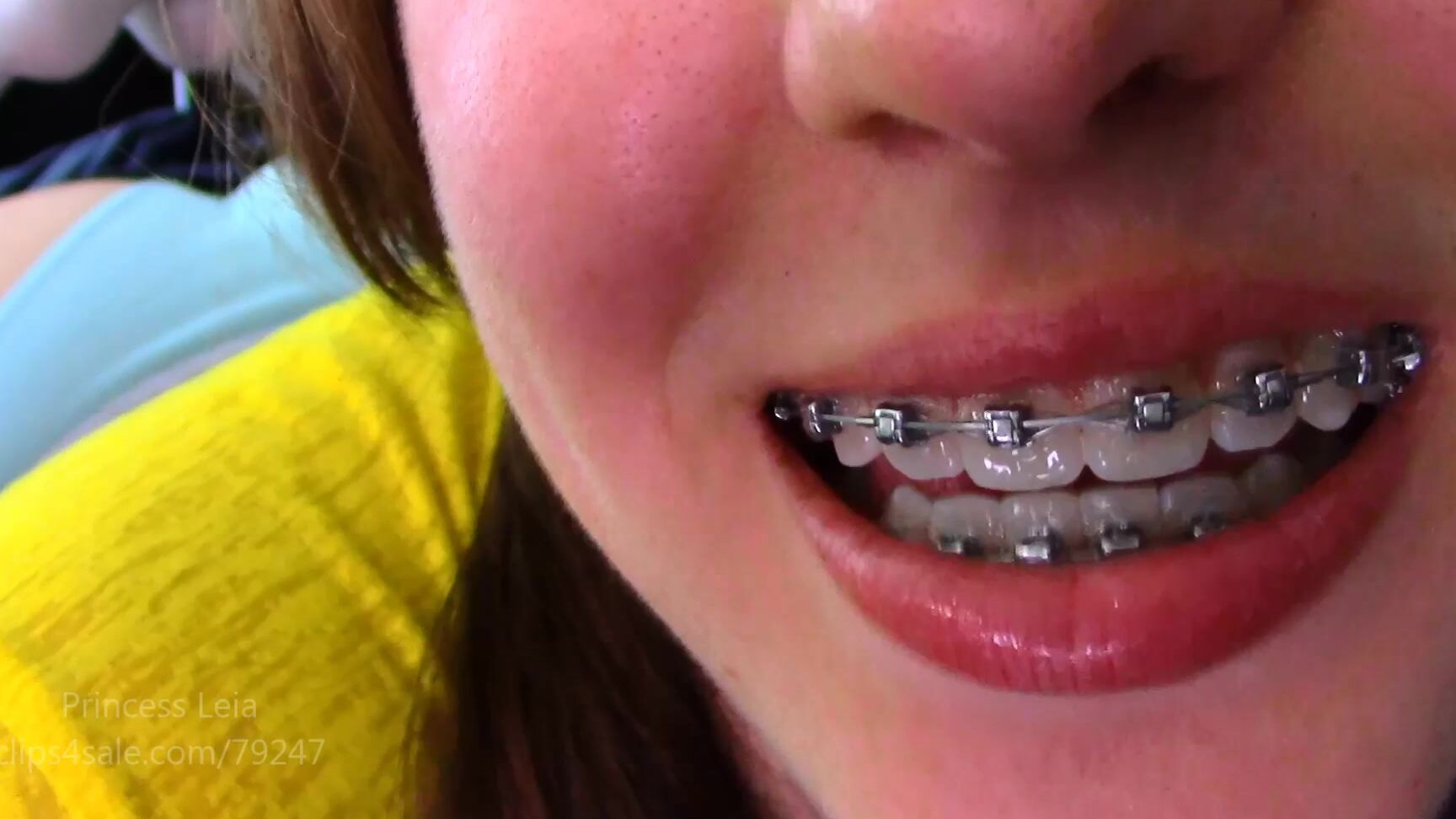 Princess Leiacm Leias Braces Joi P