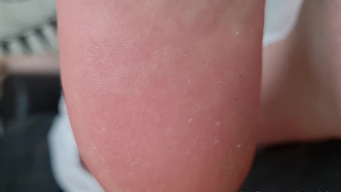 The Foot Dungeon Nicknamed The Foot Dungeon Onlyfans Goon Over My Dry Tired Feet And Drool Over All The Dead Skin Barely Clinging To My Toes I Know You