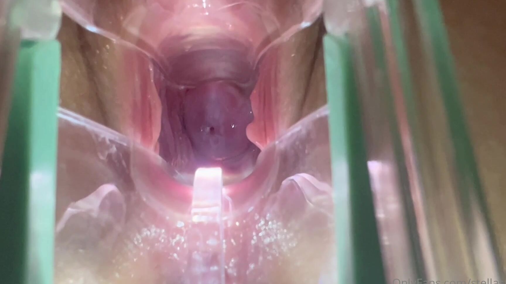 Stellastrosepremium Internal Pussy And Cervix Views For All You Extreme Pervs Out There You Have All S