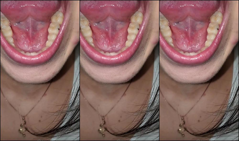 Tootsiepoptoes Mouth Tour