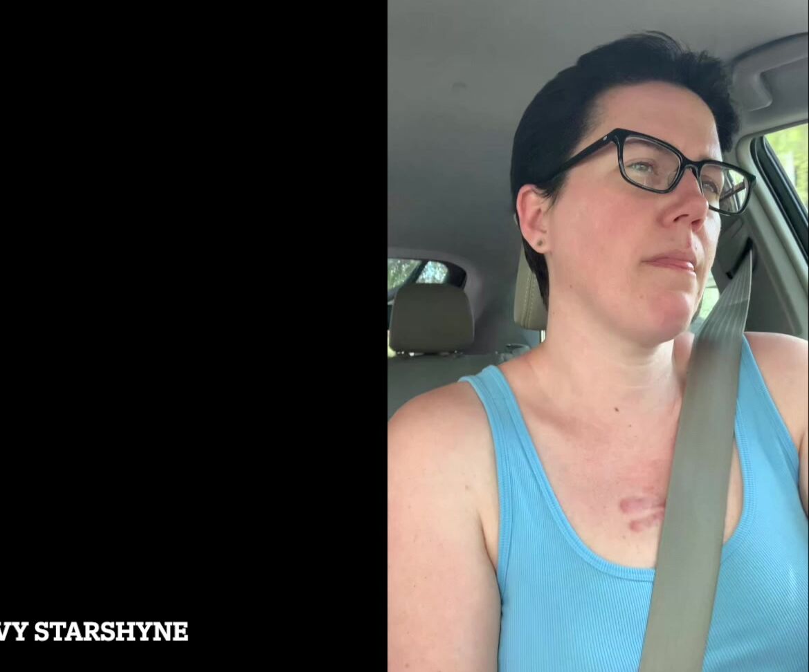 Ivystarshyne Stinking Up The Car