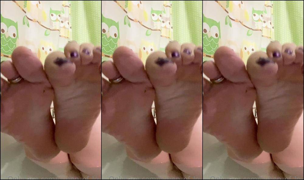 Monkey Solez Dry Heels From This Week Do T Mind If Ya Do