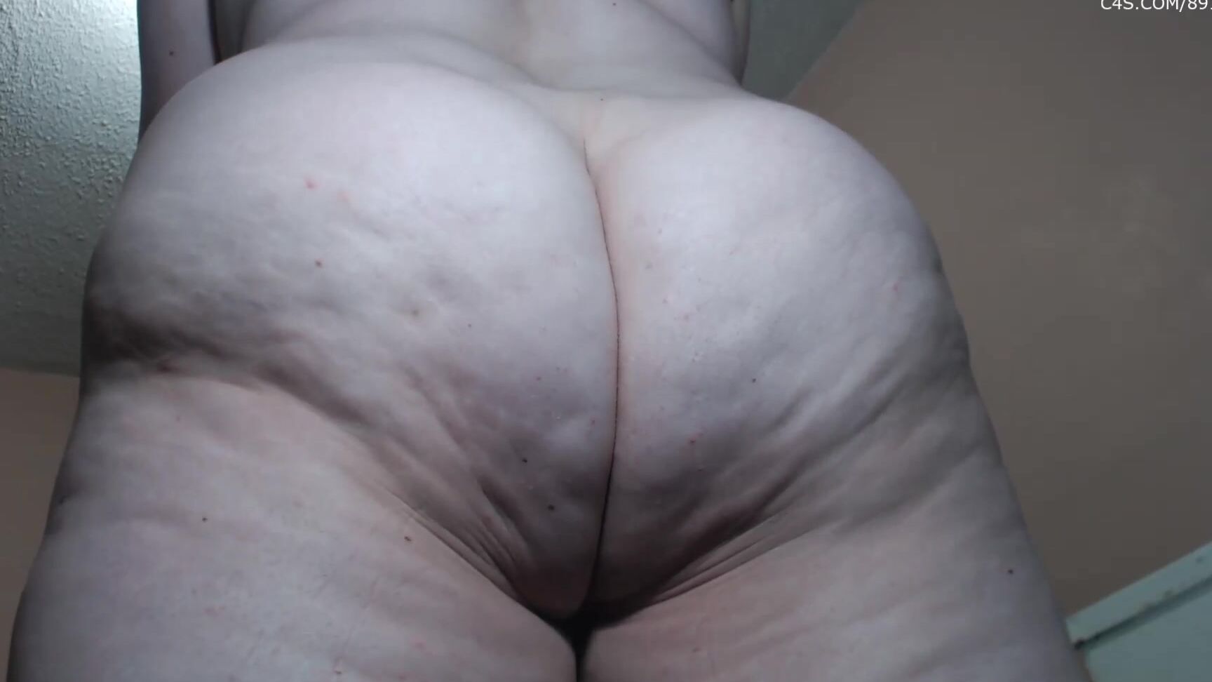Booty U Big Lumpy Cellulite Booty