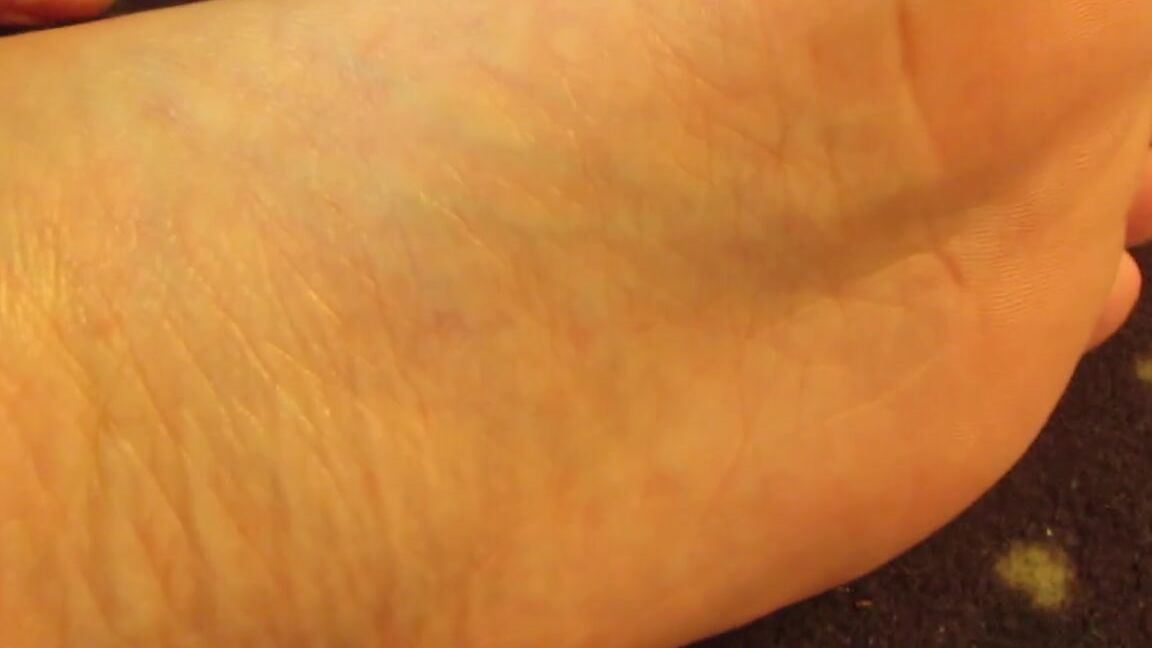 Neolasoles Nicknamed Neolasoles Onlyfans I Was Sitting In The Sun Thats Why Im So Yellow P And My Pedicure Normally