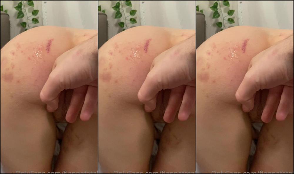 Fiannafatale 2401553134 03 25 2022 The Biggest My Hole Has Ever Been Stretched I Was Scrolling Through Old Video And Found