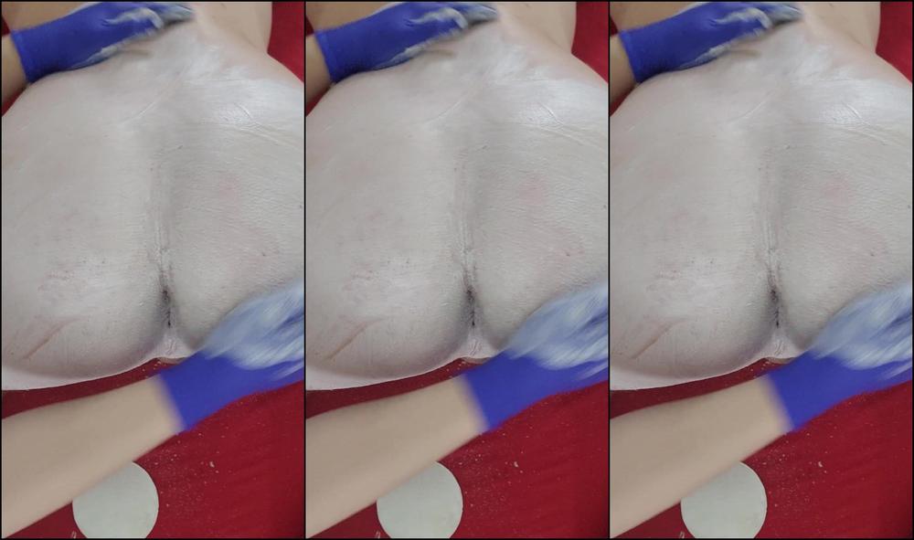 Skysugaring 3000128462 09 01 2023 Labor Day Weekend Mud Pimpleass Treatment