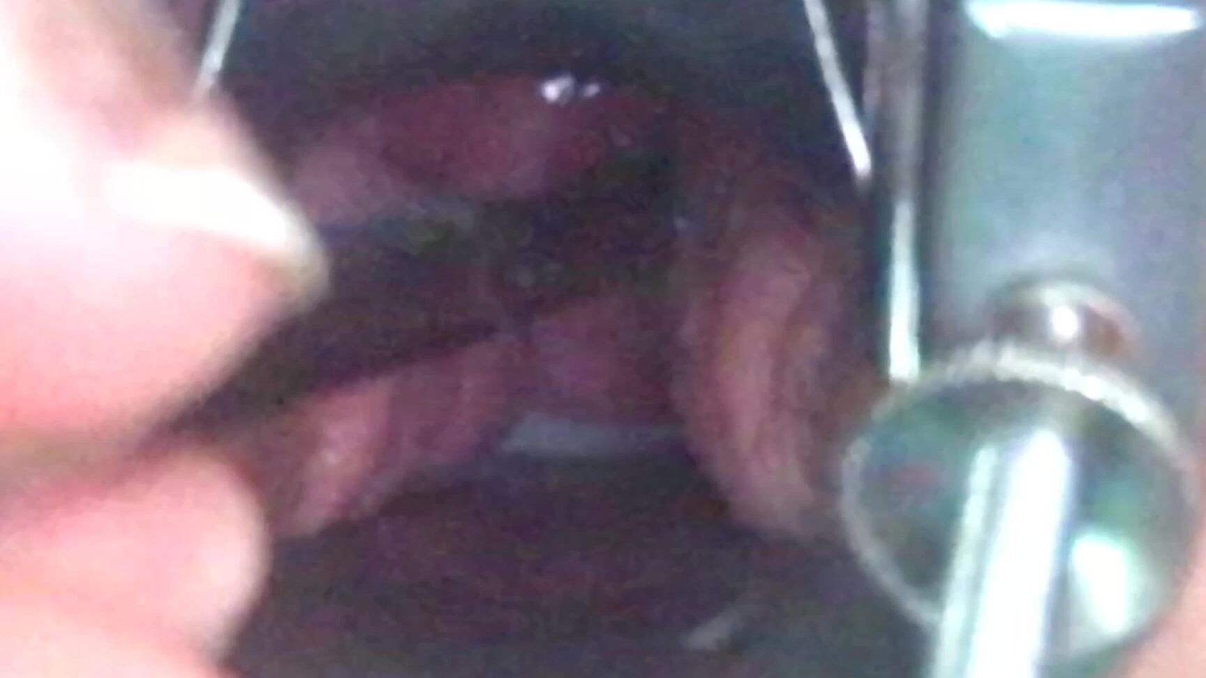 Sounding, Kink, Fetish, Gape, BBW lilithnox cervix sounding compilation ManyVids