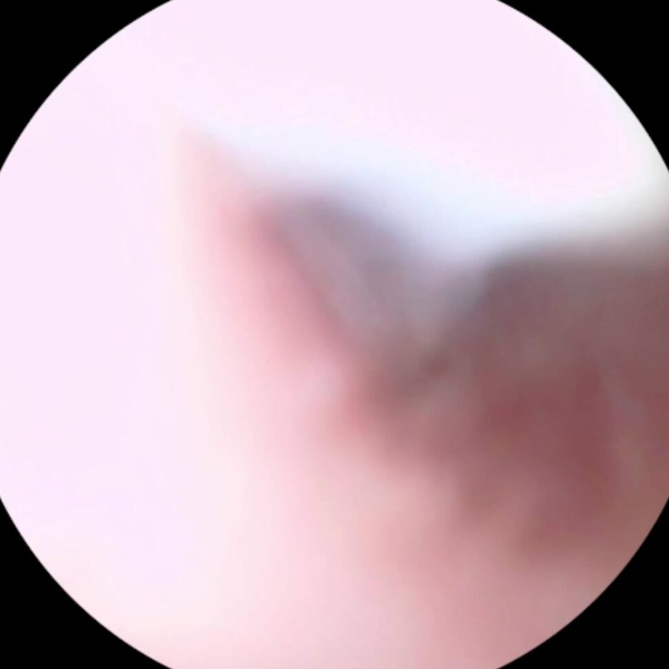 "LongHairLuna" doctor, ear fetish, giantess, skin cleansing, wax play Ear Wax Cleaning manyvids