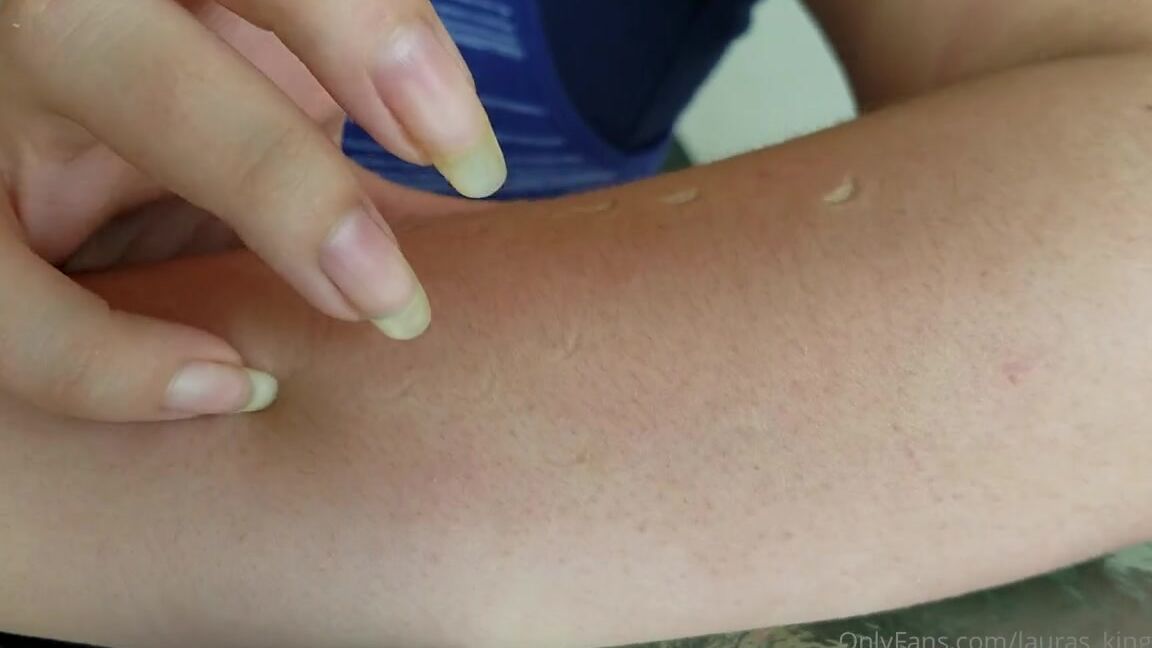 Lalalaura Nicknamed Lauras Kingdom 01 04 2021 Onlyfans Video Knicole Digging Knicole Digs Her Sharp Long Natural Nails Into Her Skin