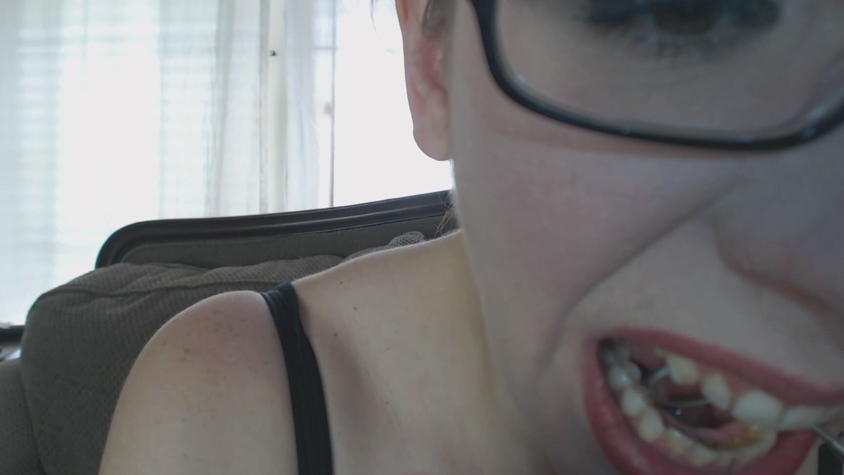 Canadiansammy Sammy Scrapes Her Teeth With Dental Tool