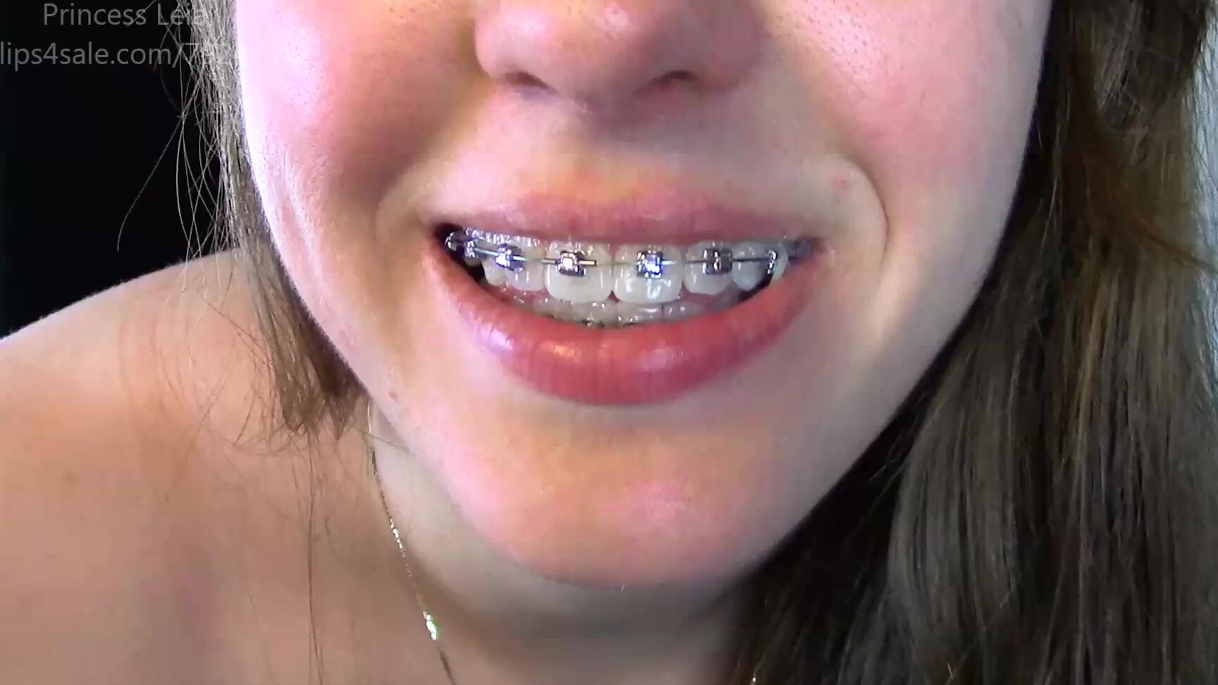 Princess Leiacm Embracing Braces P