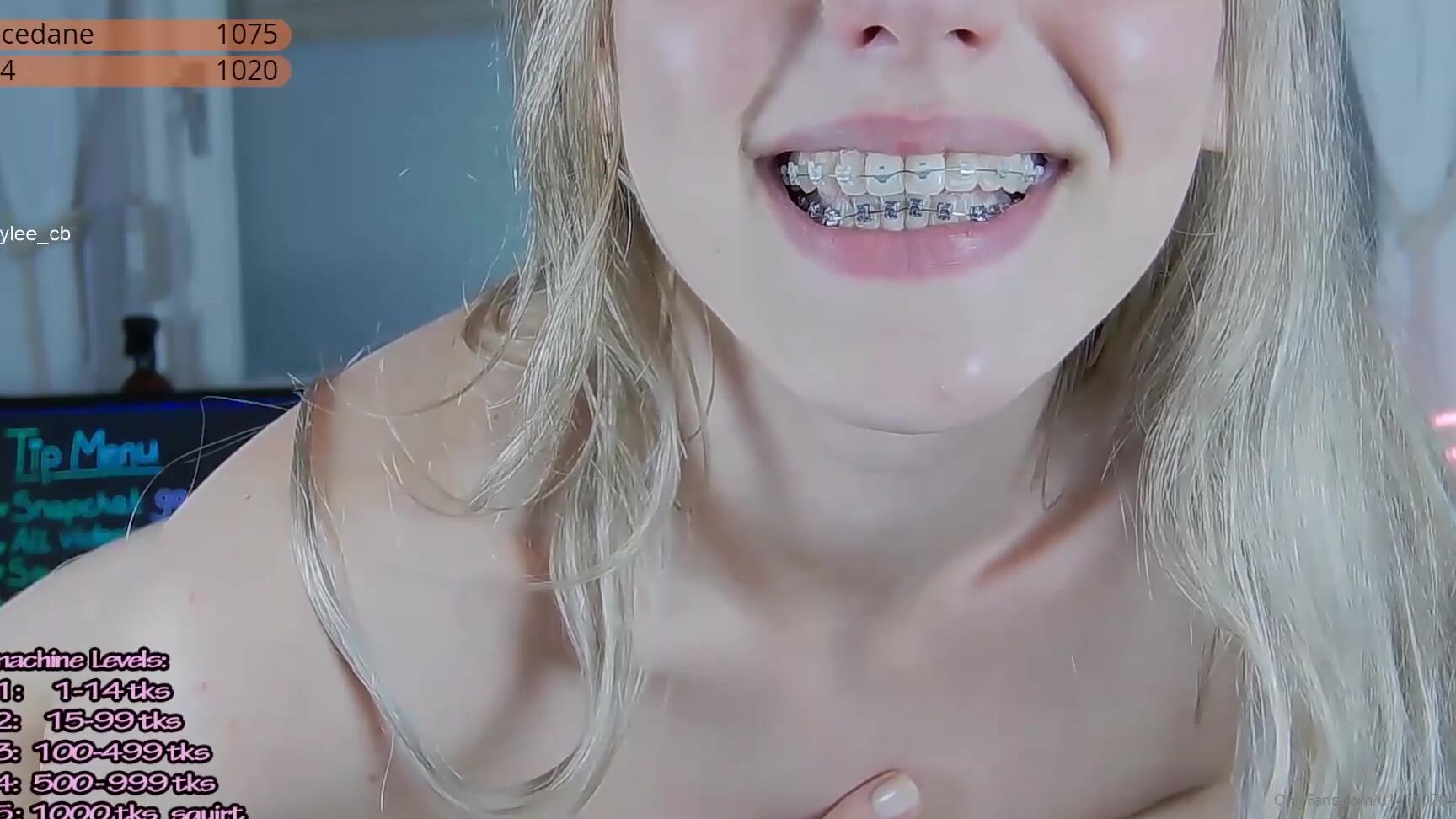 hayleex-03-04-2020-211058480-showing-my-braces