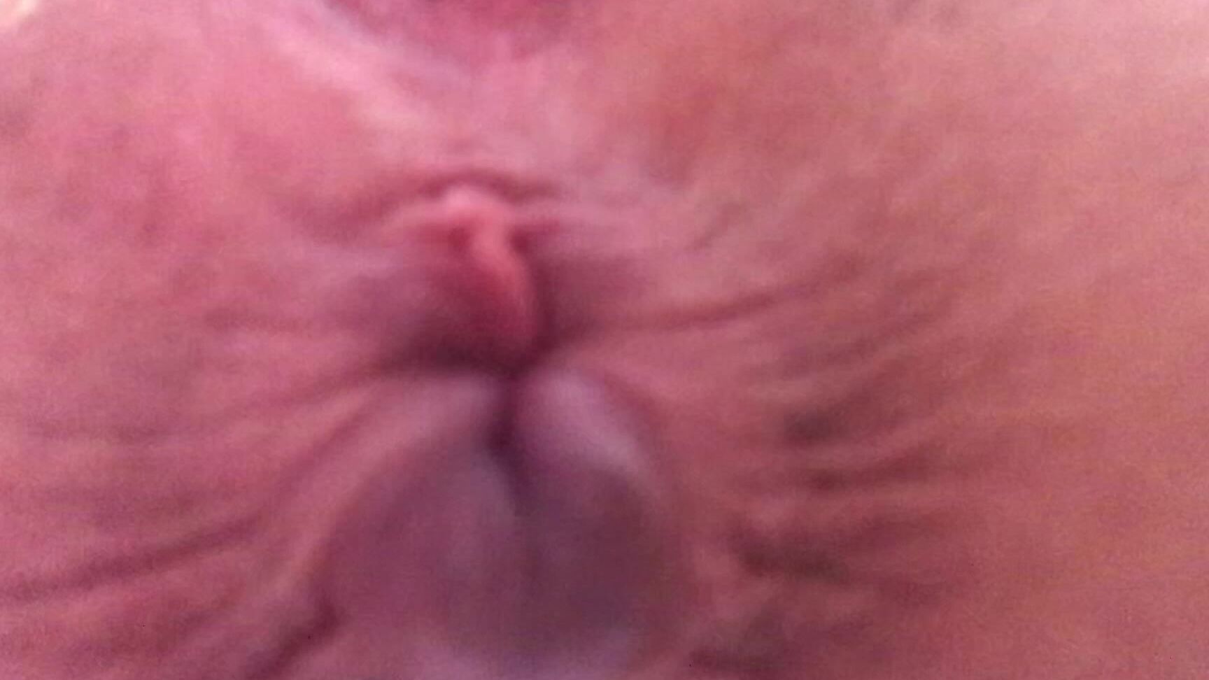 Kallmekrystal Eat My Ass Loser