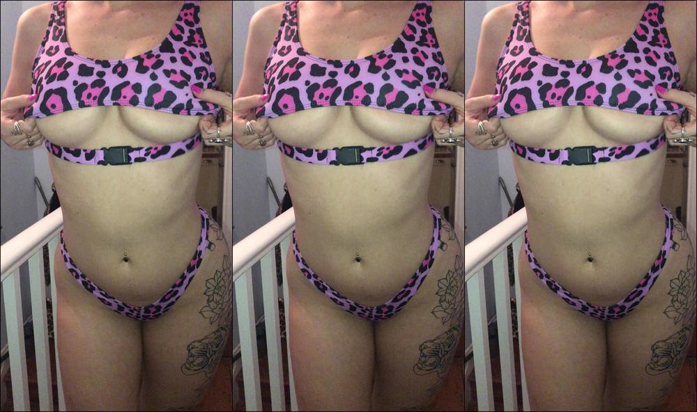 Pregnant Fox Who Wants To Join Me