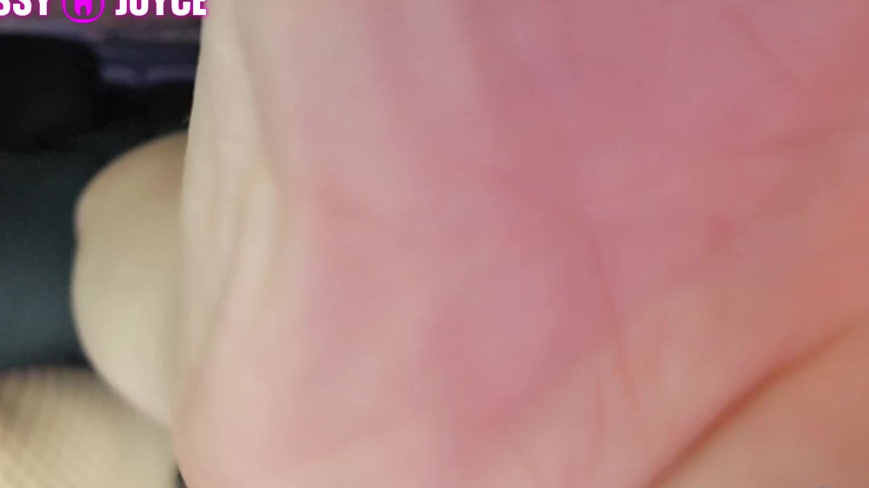 Sissyjoyce Full Video After My Electrolysis Permanent Hair Removal I Felt Very