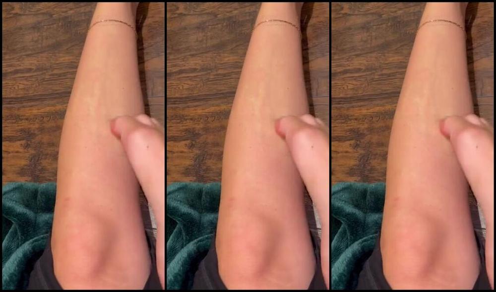 Greek Goddess Li Aka Greekli77 11 25 2024 Onlyfans Video More Scratching Content My Skin Is So Sensitive