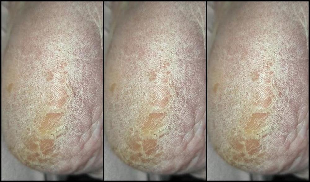 Maddison Spoilt Nicknamed Maddisonspoilt 09 11 2024 Onlyfans Video Cosy Night In You Can Get Busy On My Dry Soles And Heels