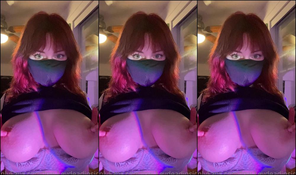 Low Keydeadinside 2022 11 08 Sorry For Not Posting Everyday This Week The Gum Surgery Clapped My Cheeks