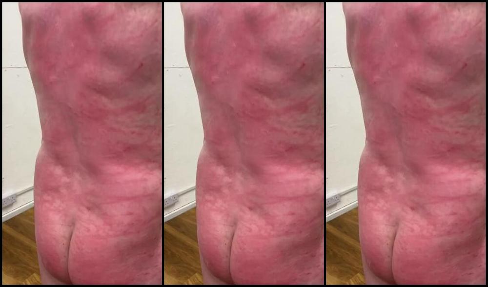 Ladydarkangeluk Onlyfans Ended Up Using A Bunch Of Birch Harsh