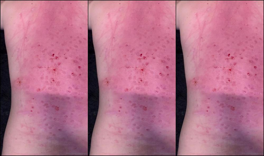 Lady Dark Angel Had A Fab Trampling Session This Morning Look At These Beautiful Marks