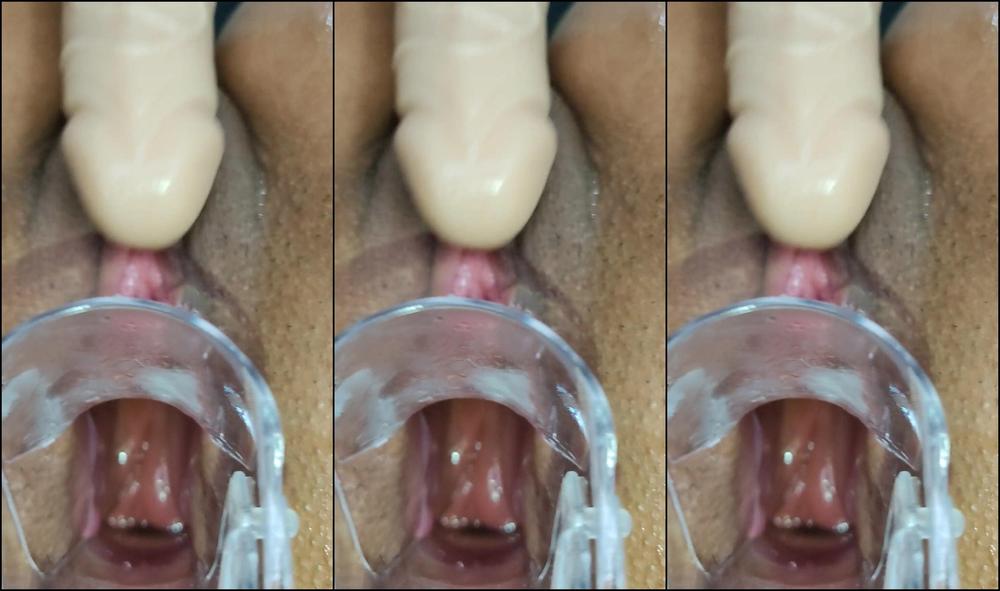 Xamy Nice View Of A Speculum In My Big Ass