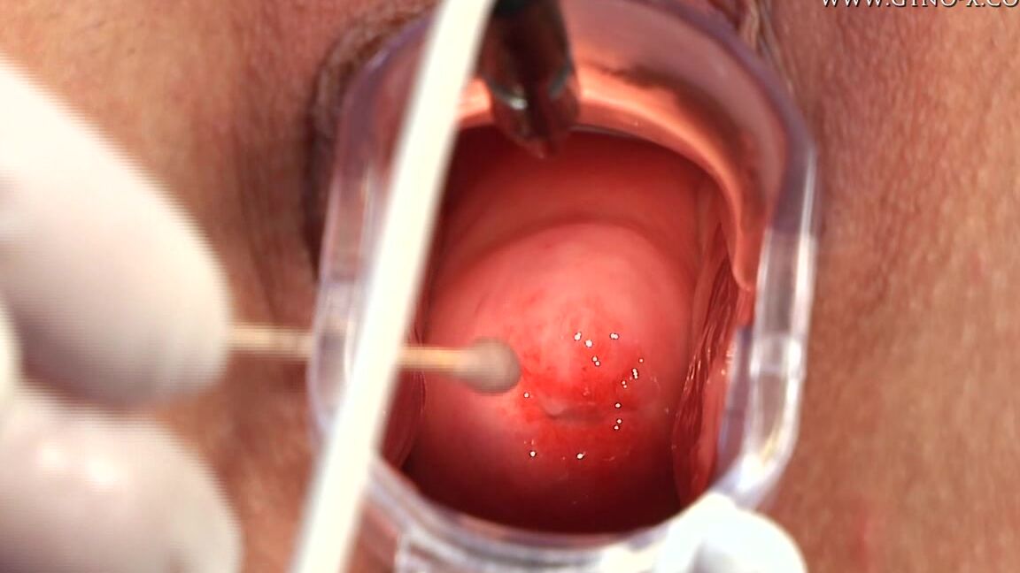 Laura Crystal Gyno Exam_2 SiteRip