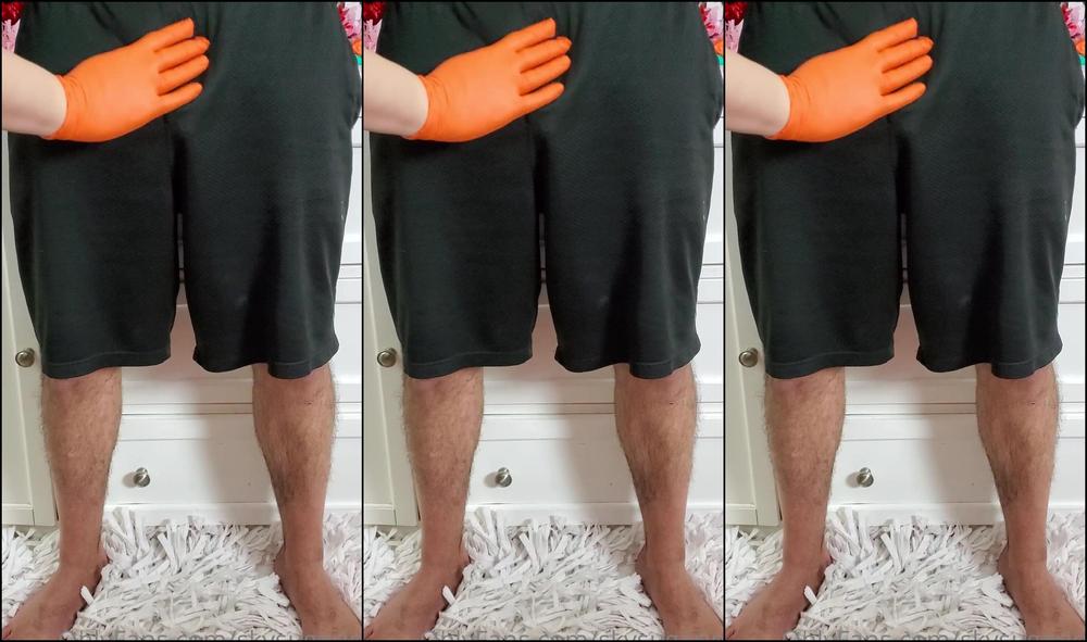 Skysugaring 2010361134 01 16 2021 Before Sugaring U108638707