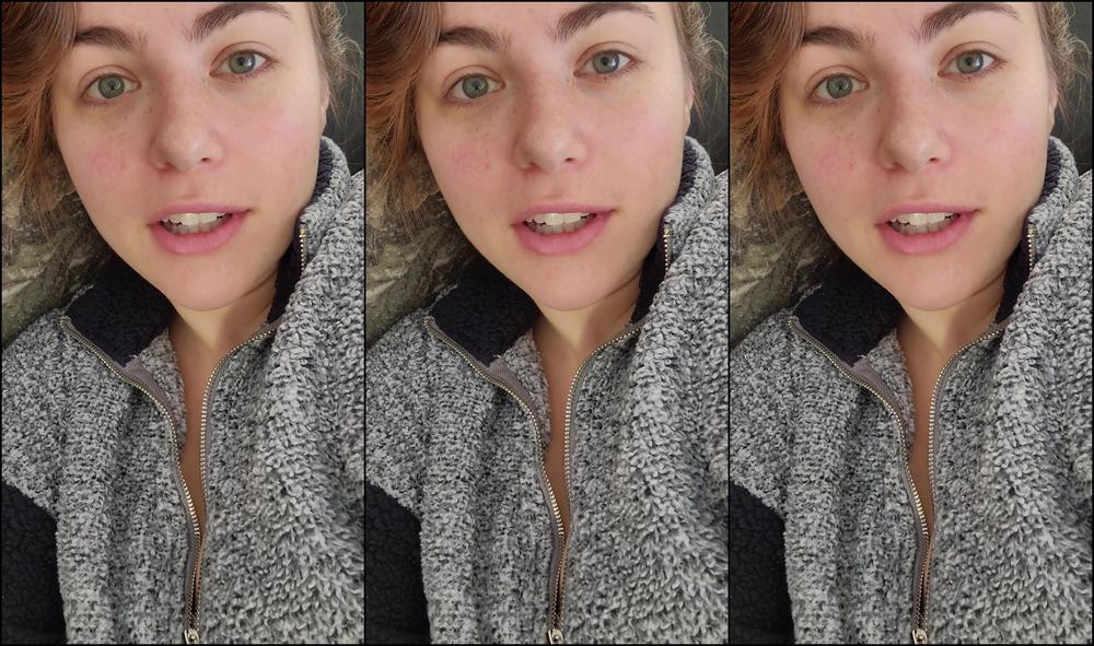 awesomekate-21-02-2021-2037702308-i-had-a-toy-firetruck-dropped-on-my-face-so-please-ignore-my-busted-lip