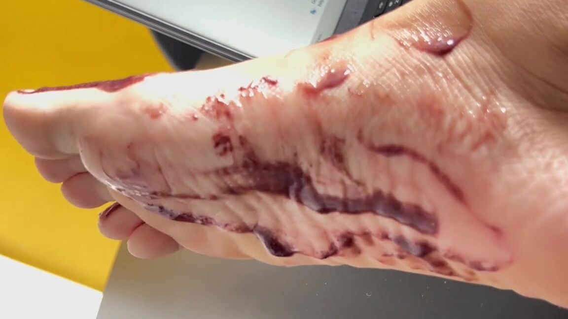 Miillee Santos Nicknamed Miillee Santos 12 18 2024 Onlyfans Video Do You Like Acai