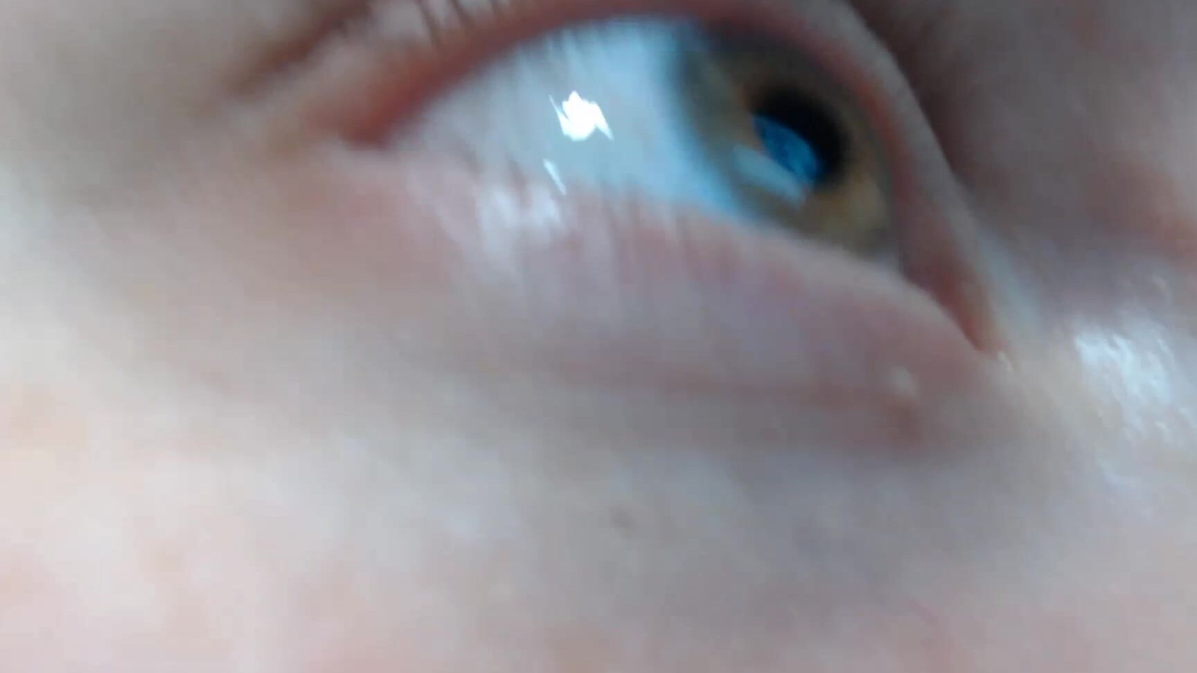 Booty U Throbbing Under My Eye