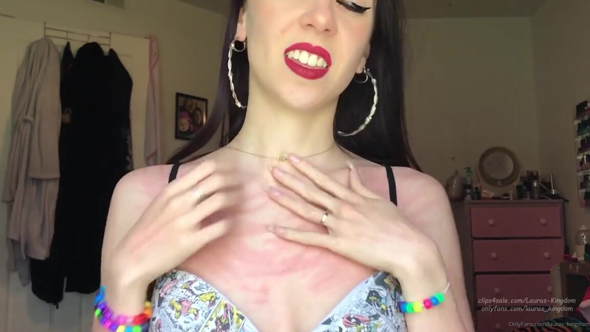 Lalalaura Nicknamed Lauras Kingdom 08 31 2020 Onlyfans Video Madis Aggressive Scratch You Guys Will Love This One Madi Finally Scratches Hard In This