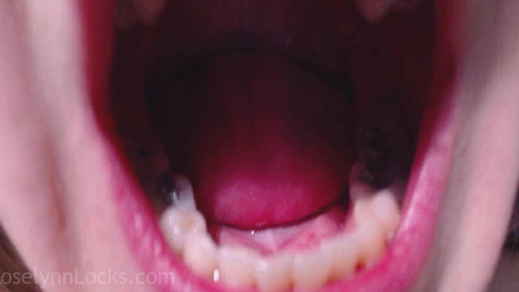 Roselynnlocks Teeth Talk Manyvids
