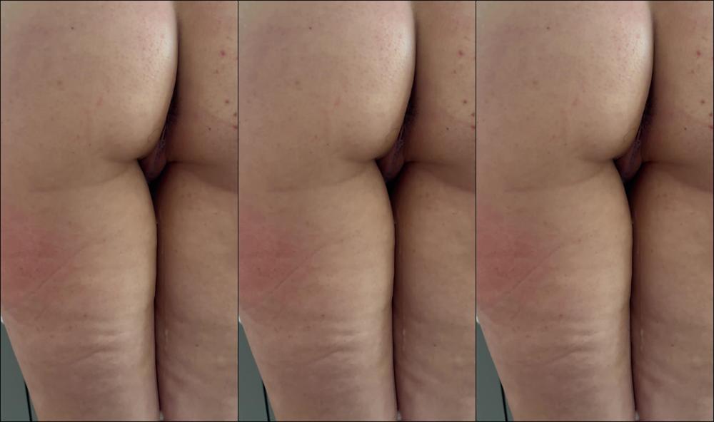 Diet Marshmallow 210