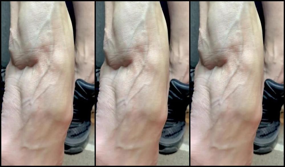 Lezlyan Nicknamed La Little Dancer Feet Onlyfans Veinsveinsveins I Just Finished A Work Out On My Legs As I Went To Remove