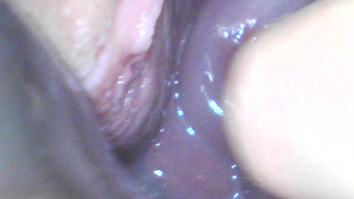 Milly Cervix Penetration And Speculum