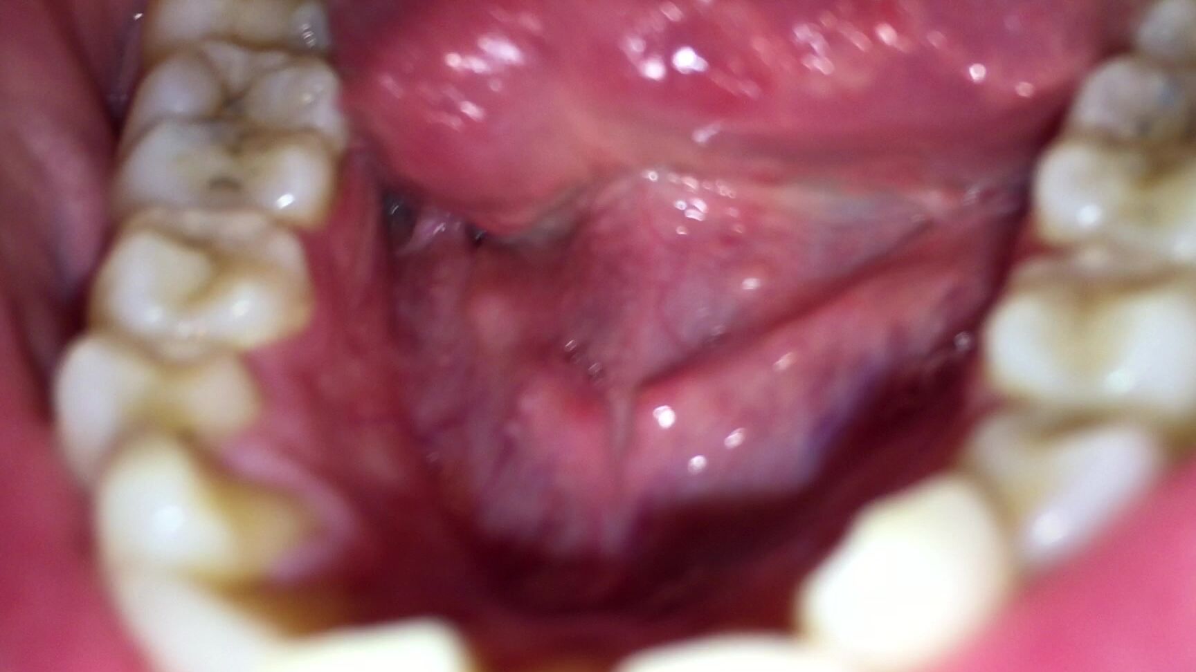 Ruby Rose Fetish Lots Of Spitting Mouth Exploriation