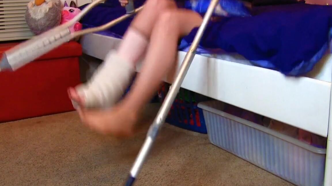 Tara Tied A Sprained Ankle For The Summerp