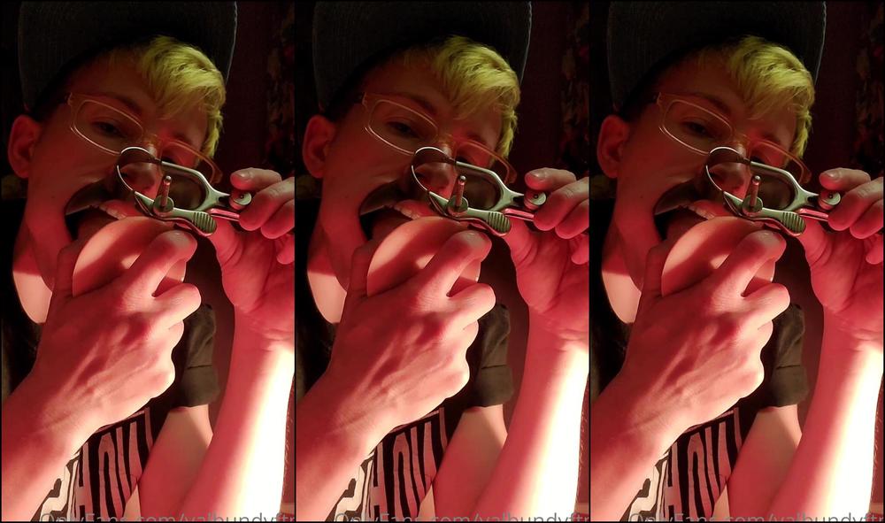 Valbundyftm Can You Check My Tonsils Doc