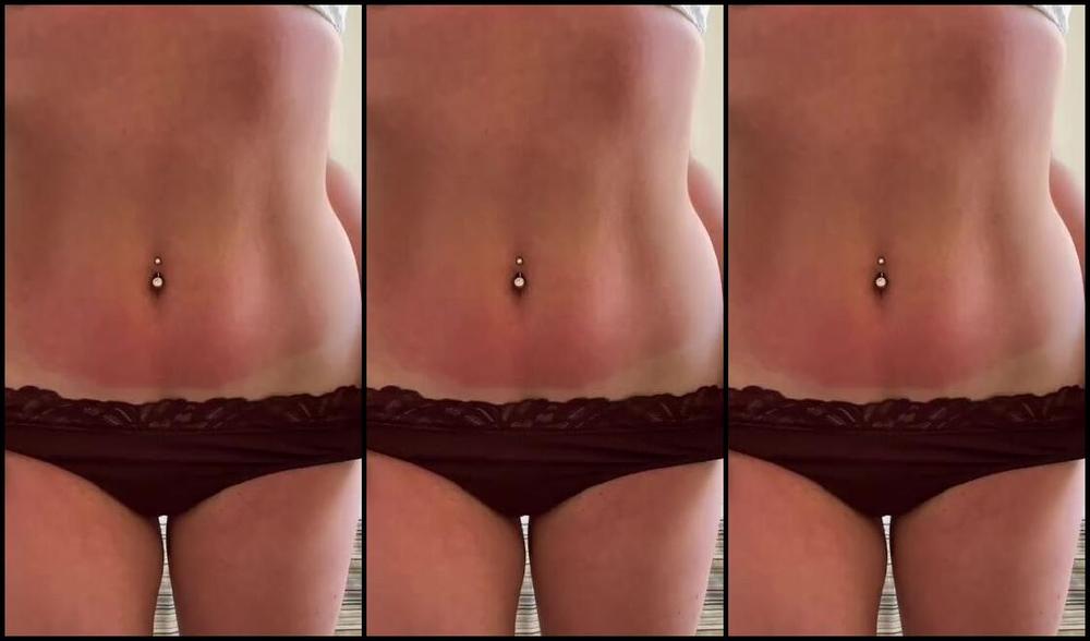 Moringa Paz Nicknamed Moringapaz 11 17 2024 Onlyfans Video I Got A Massive Sunburn The Other Day But I Like How I Look