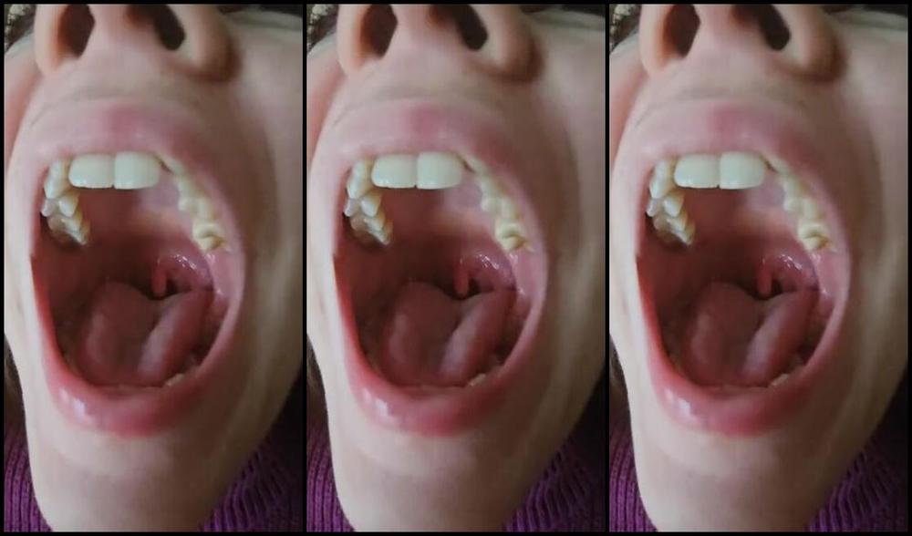 Emily Maxemilweber Nicknamed Maxemilweber 01 14 2024 Onlyfans Video My Breath Is Really Bad This Morning Davvero Pesante Il Mio Alito Questa